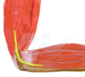 Physiotherapy cubital tunnel decompression leaflet